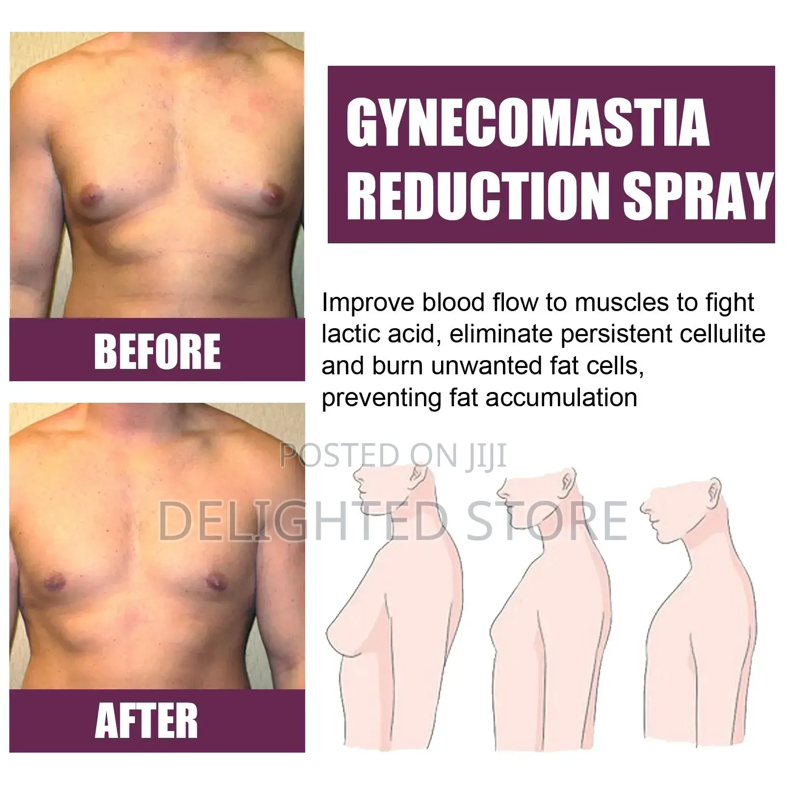 Gynecomastia (Men Chest) Firming Spray