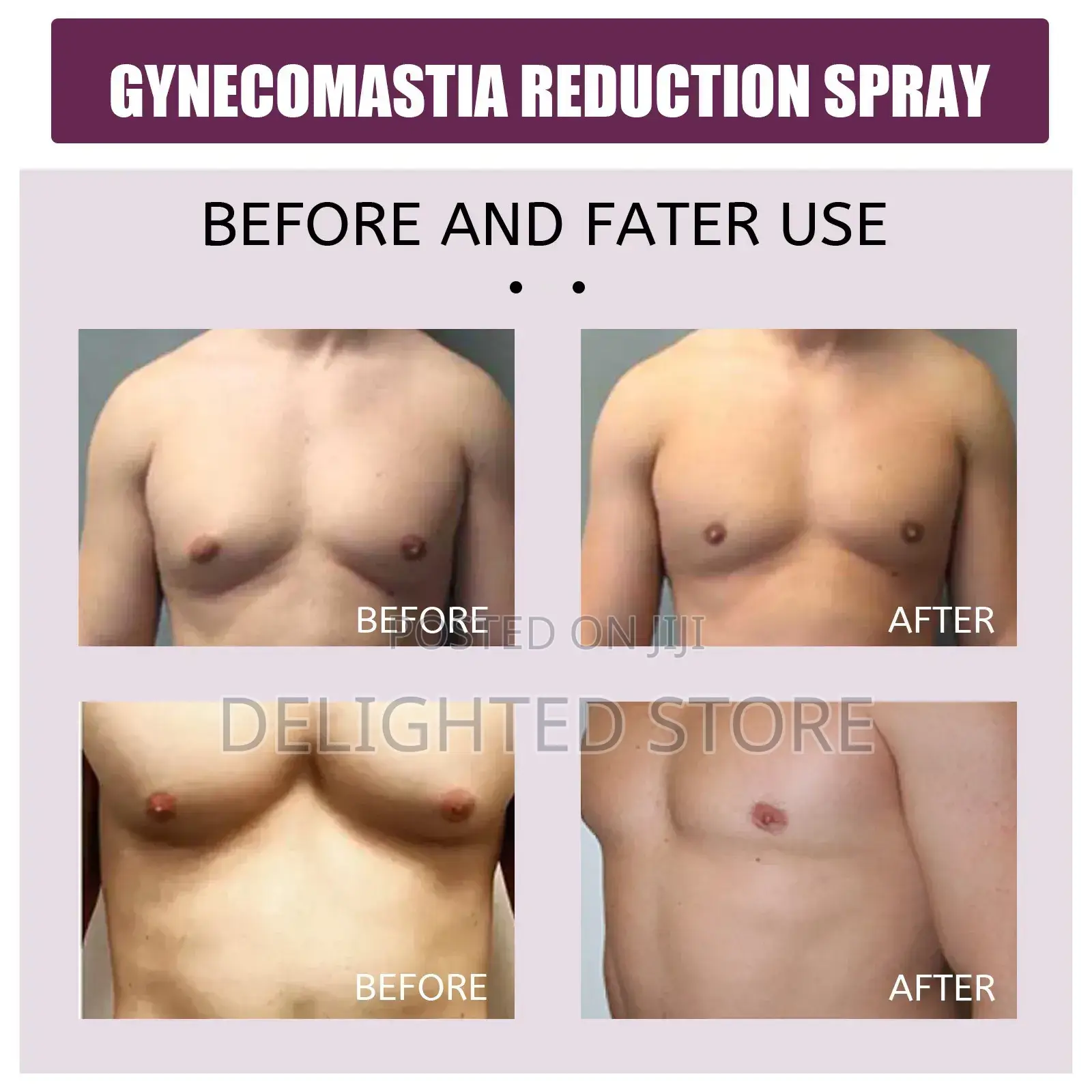 Gynecomastia (Men Chest) Firming Spray