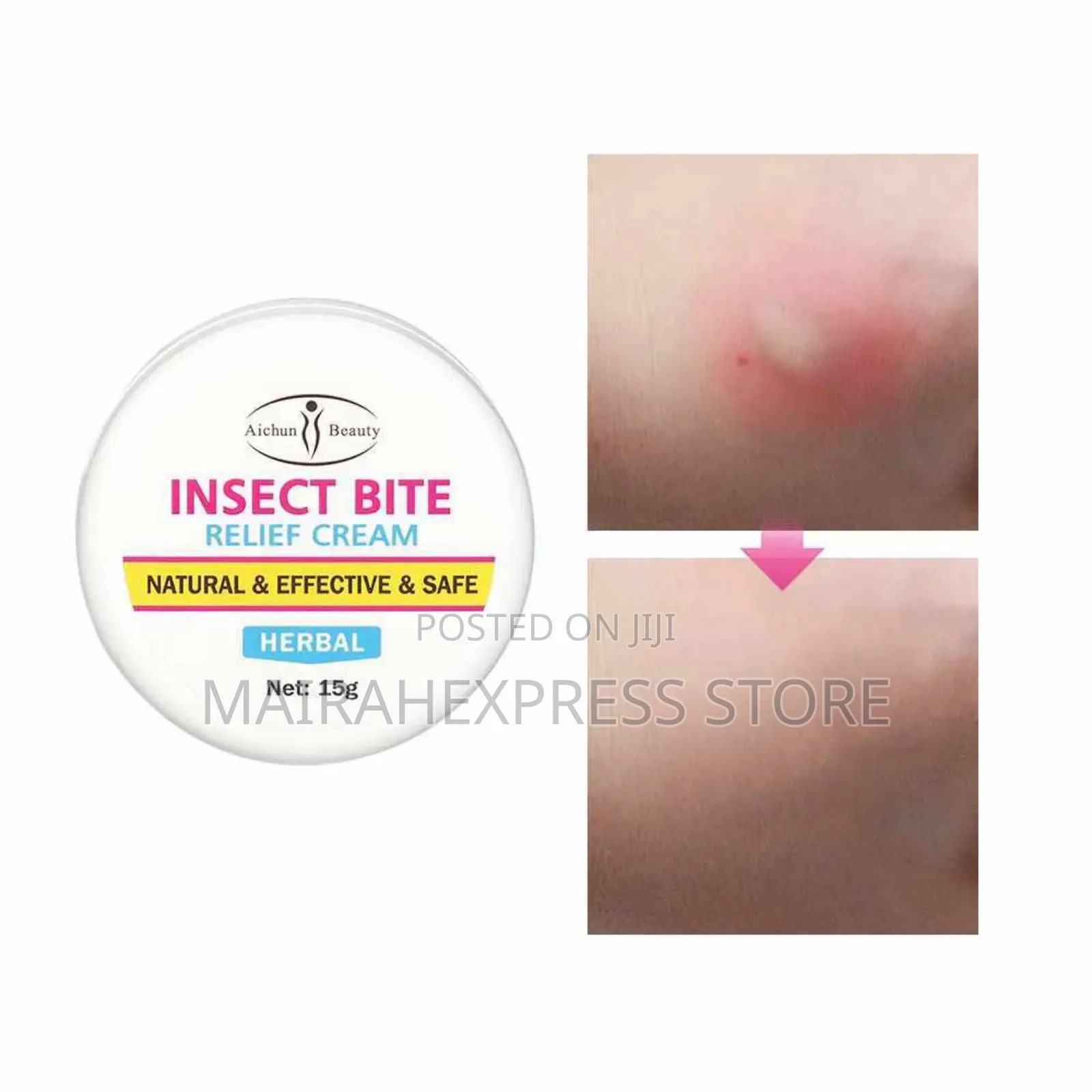 Insect Bite Relief Balm