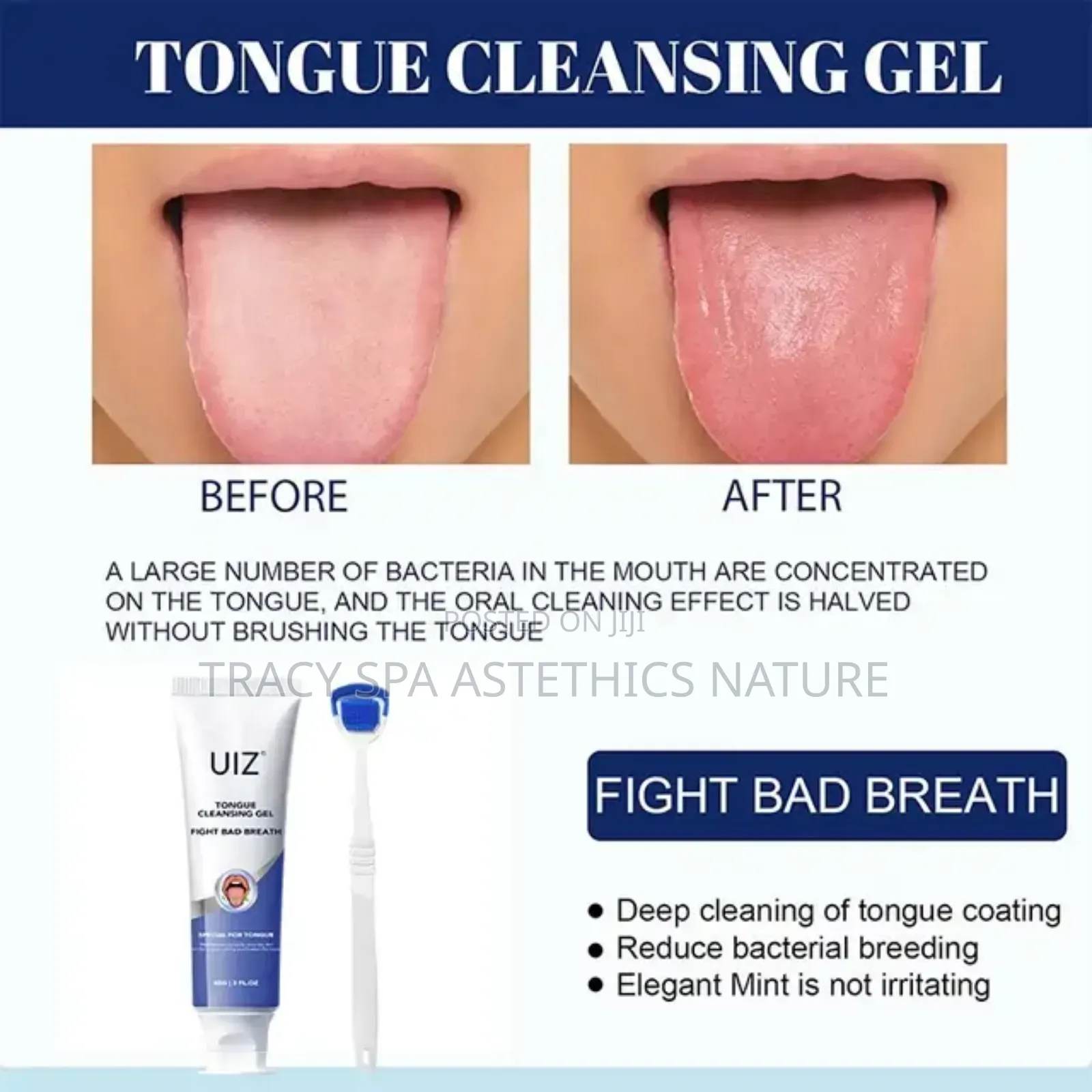Tongue Cleaner