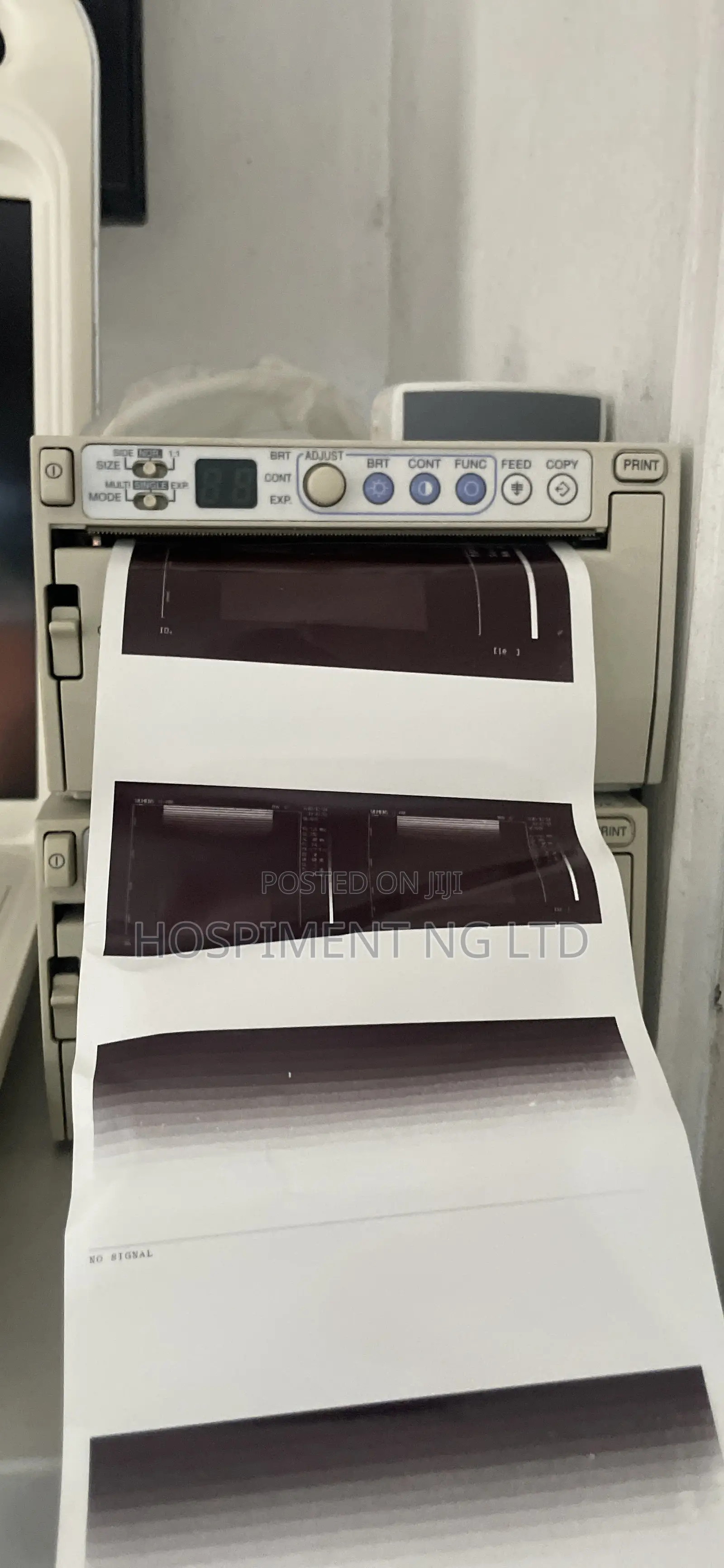 Mitsubishi Ultrasound Printer