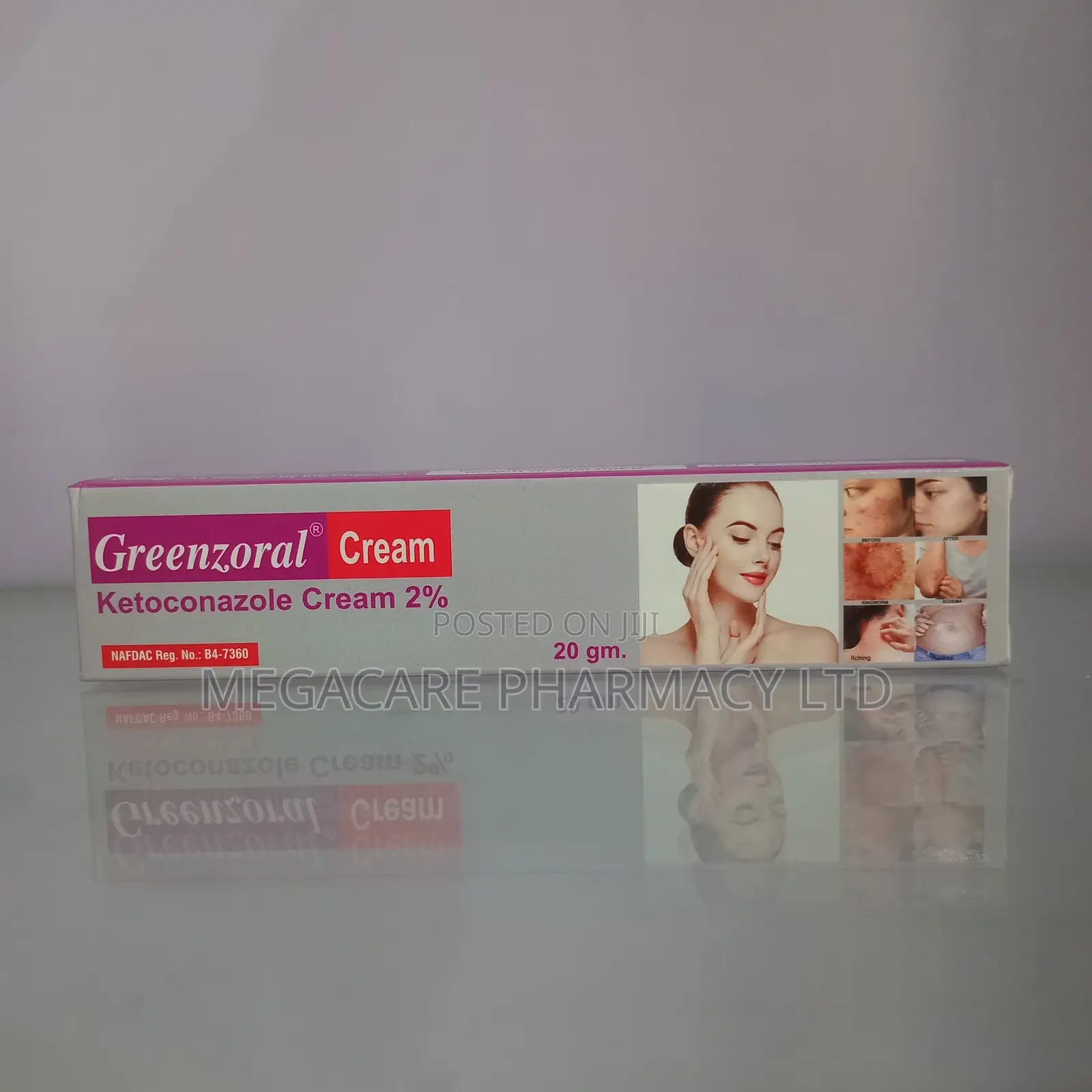 Greenzoral Cream