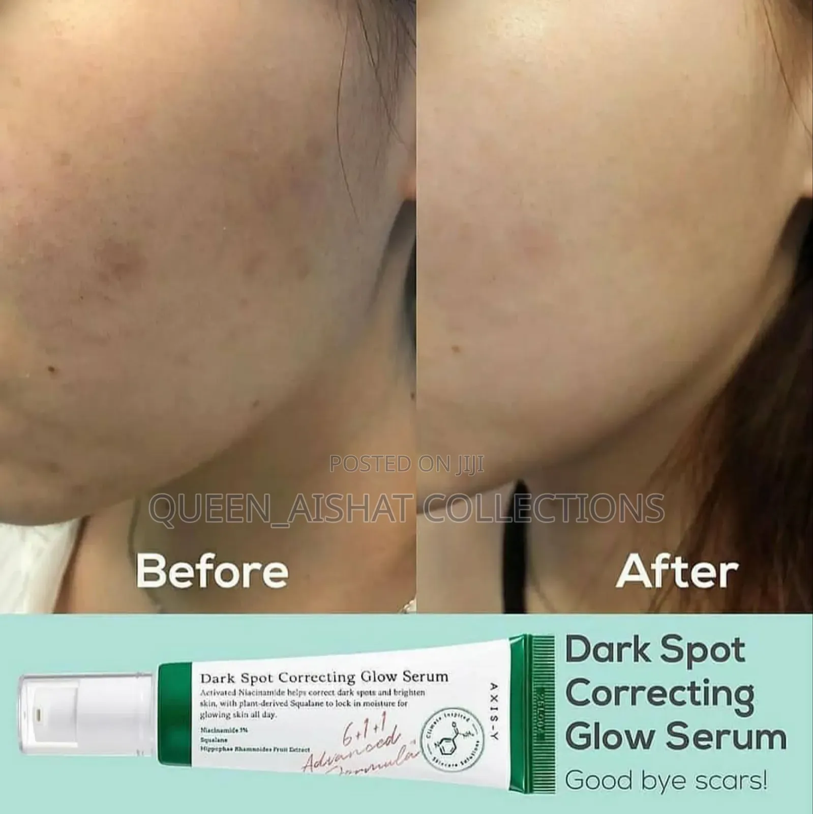 Axis-Y Dark Spot Correcting Glow Serum