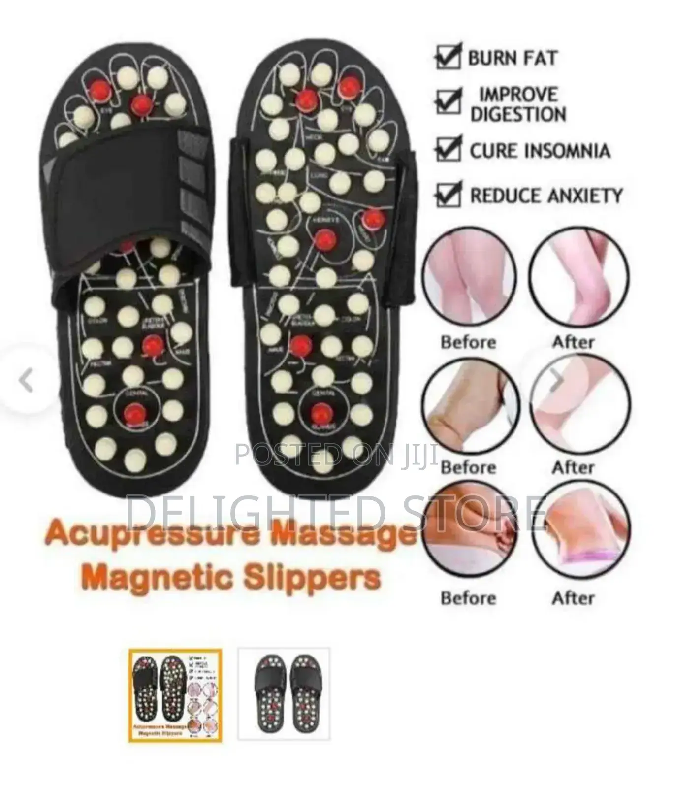 Foot Reflex Accupuncture Massage Slippers(Sizes 38-45)
