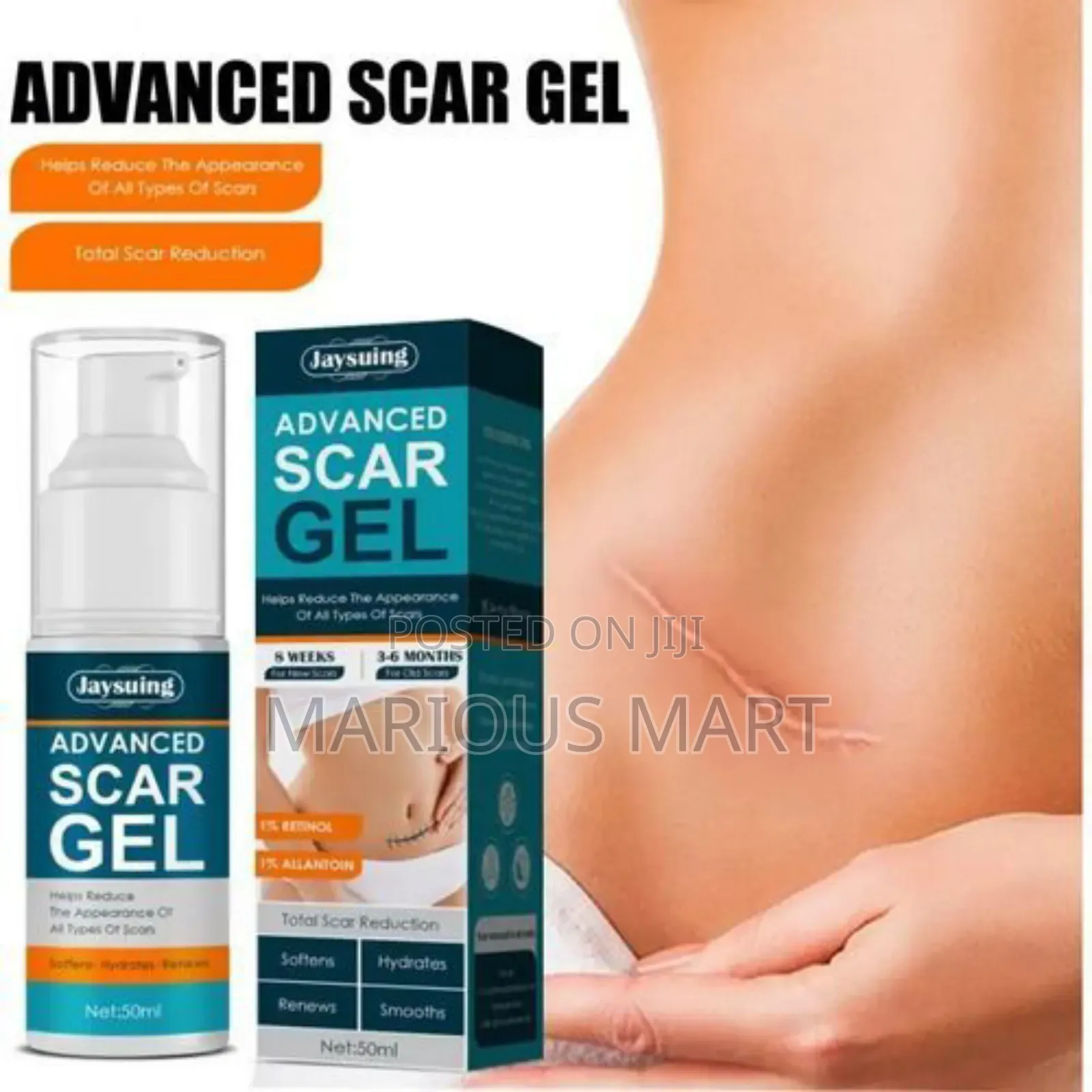 Advanced Scar Removal Cream