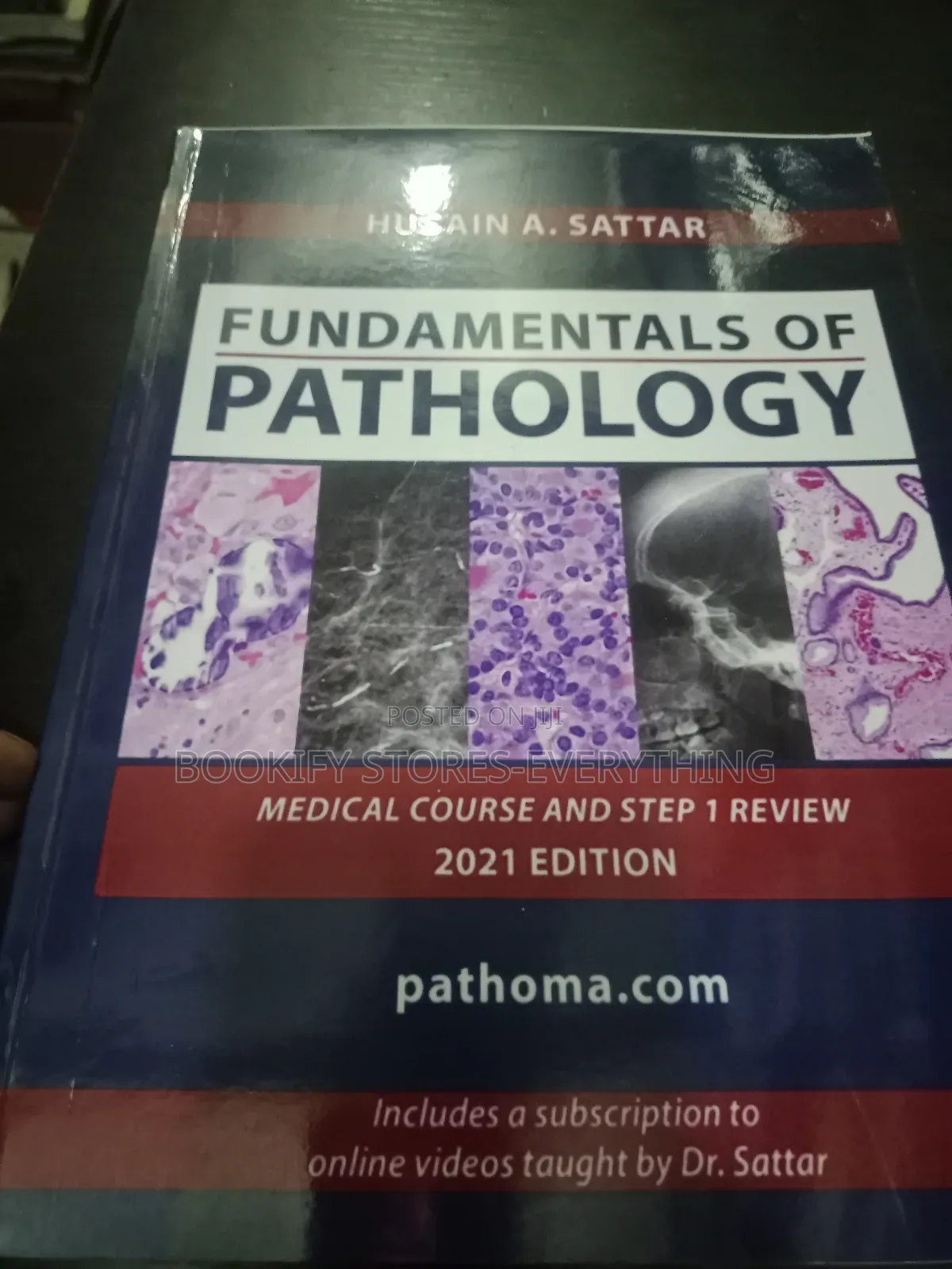 Fundamental of Pathology