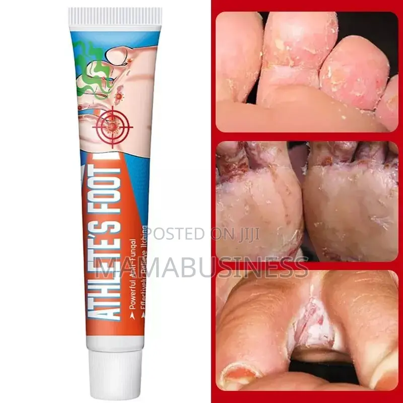 Sumifun Athlete's Foot Cream - 20g