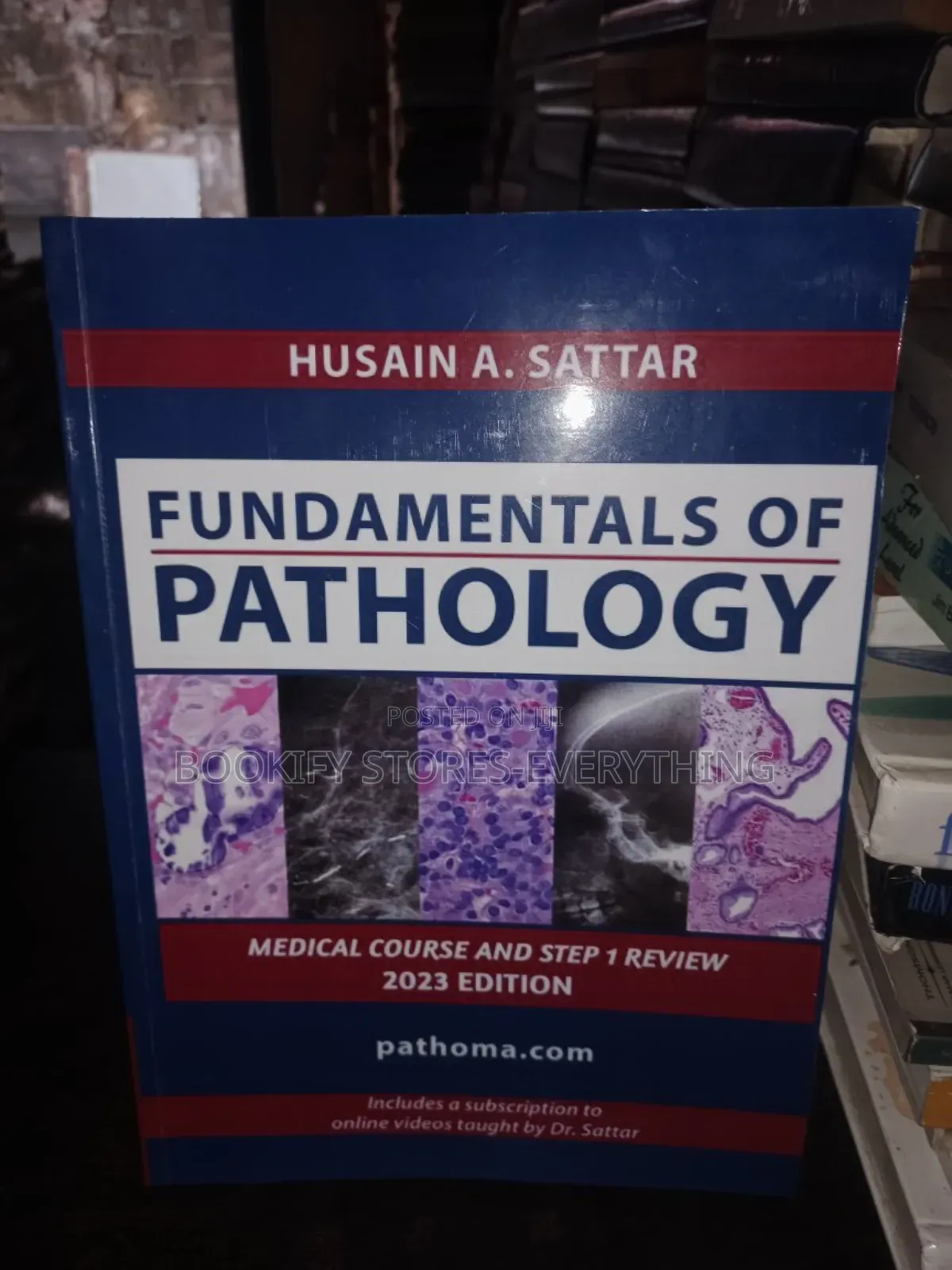 Fundamental of Pathology