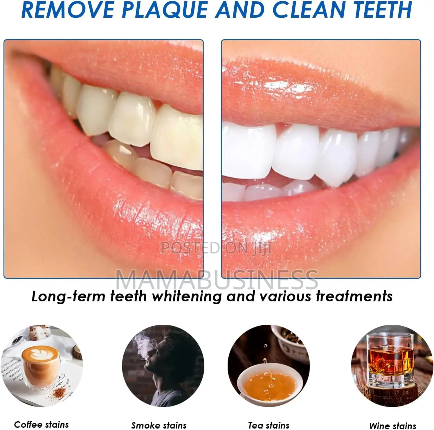 3d White Teeth Whitening Strips