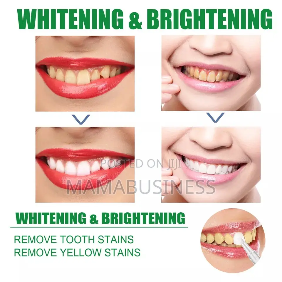 Eelhoe 7days Whitening Gel - 2pc