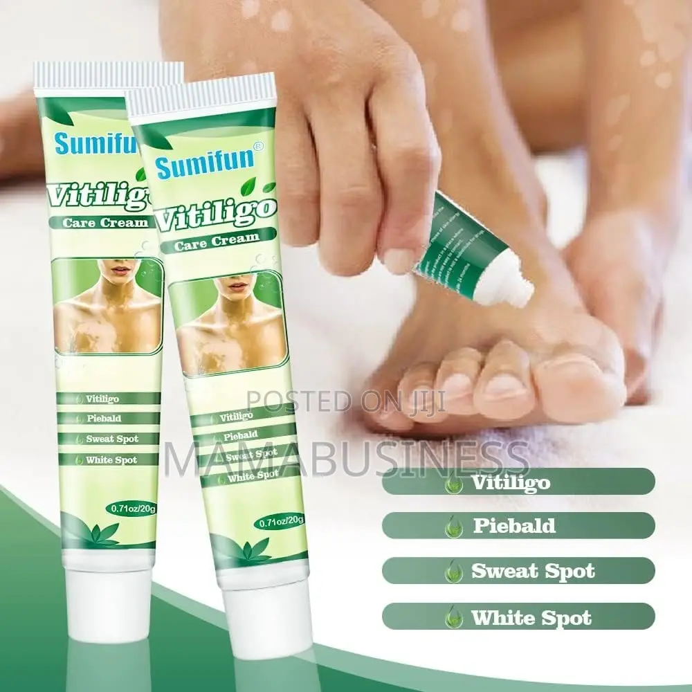 Sumifun Vitiligo Care Cream - 20g