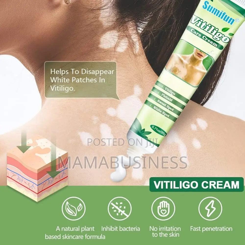 Sumifun Vitiligo Care Cream - 20g