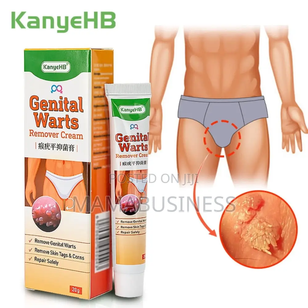 20g Kanyehb Genital Wart Remover Cream