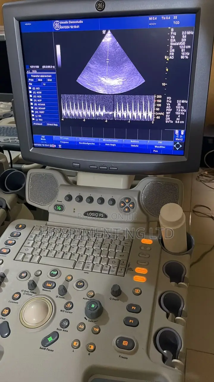 Ge Logic P5 Ultrasound Machine