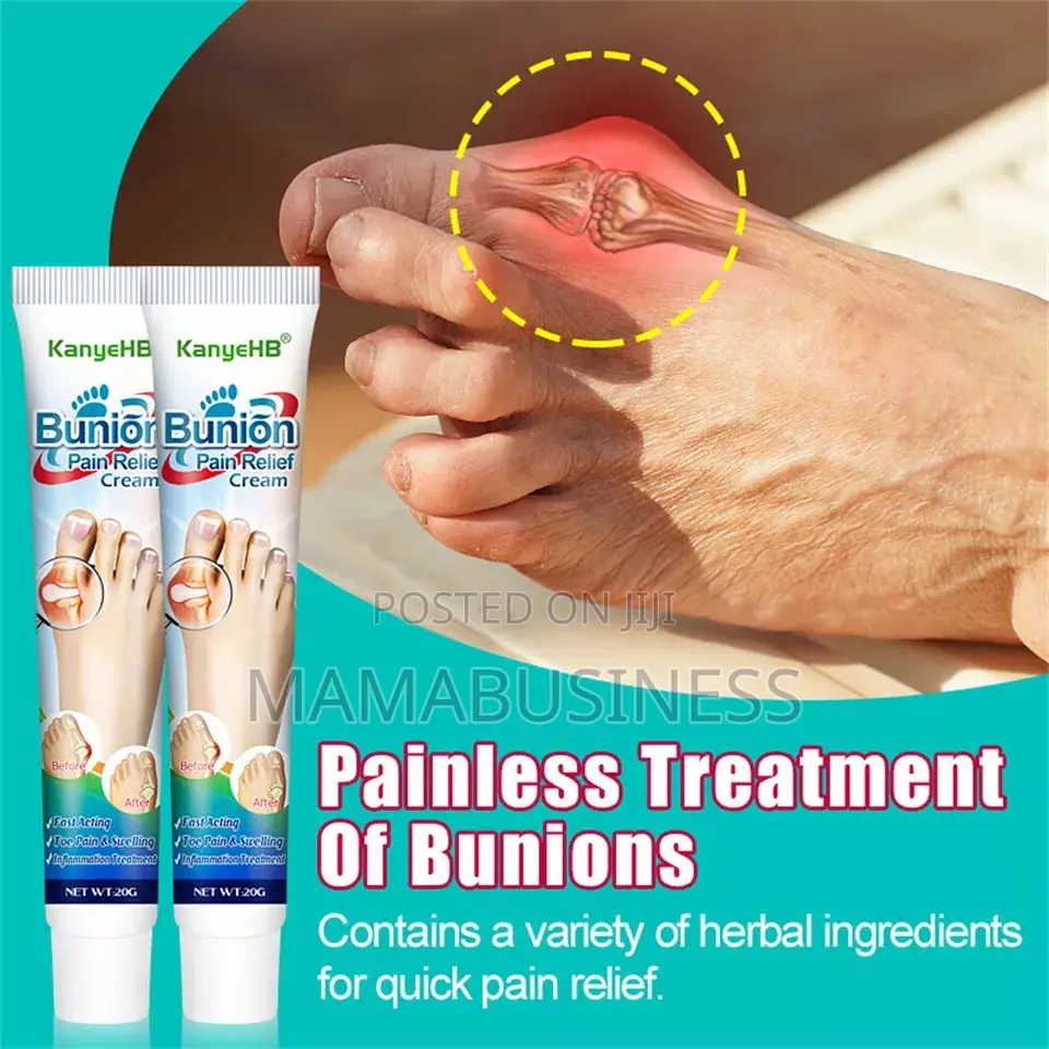 Kanyehb Bunion Pain Relief Cream - 20g