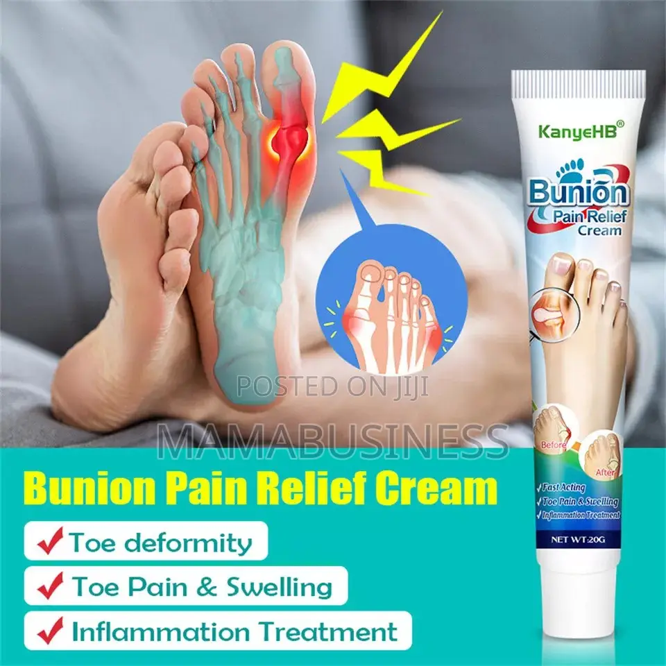 Kanyehb Bunion Pain Relief Cream - 20g