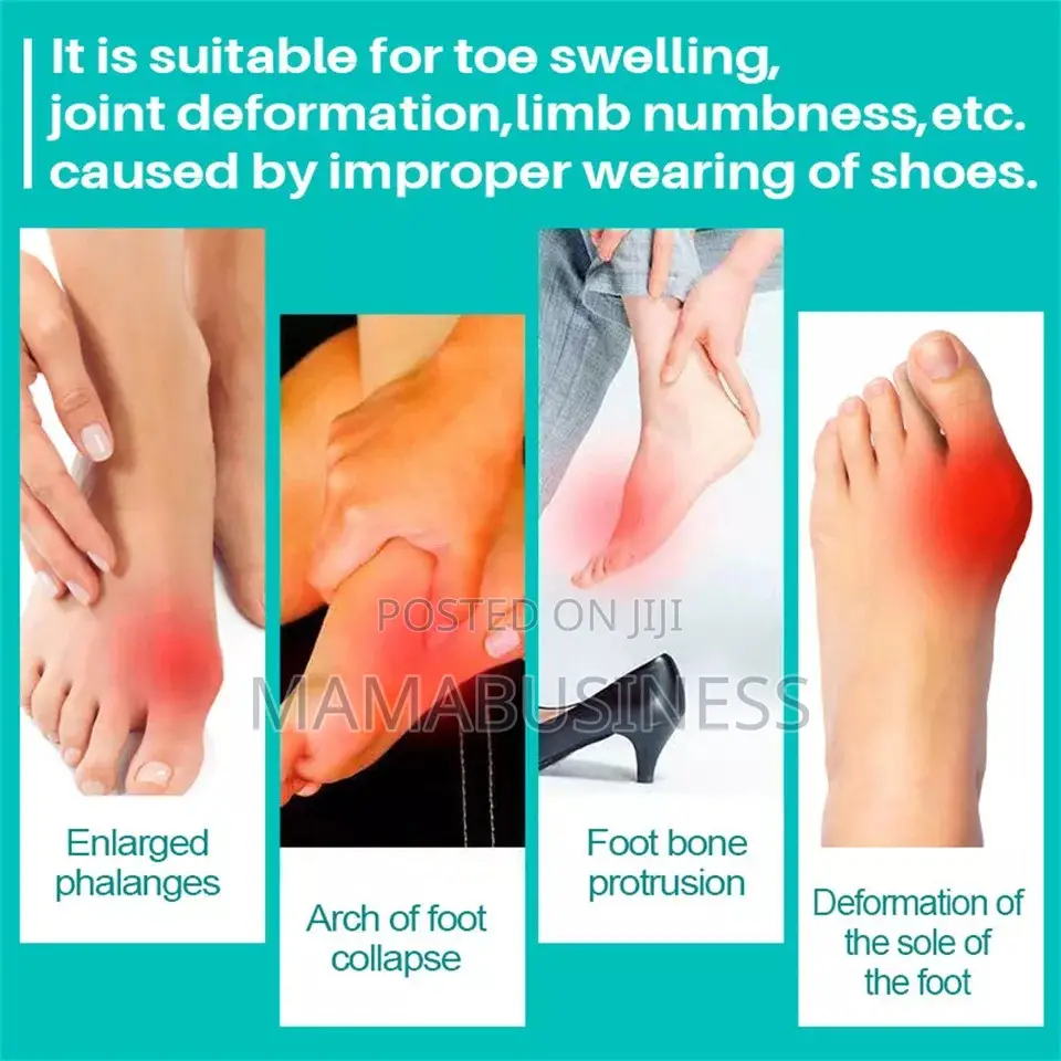 Kanyehb Bunion Pain Relief Cream - 20g