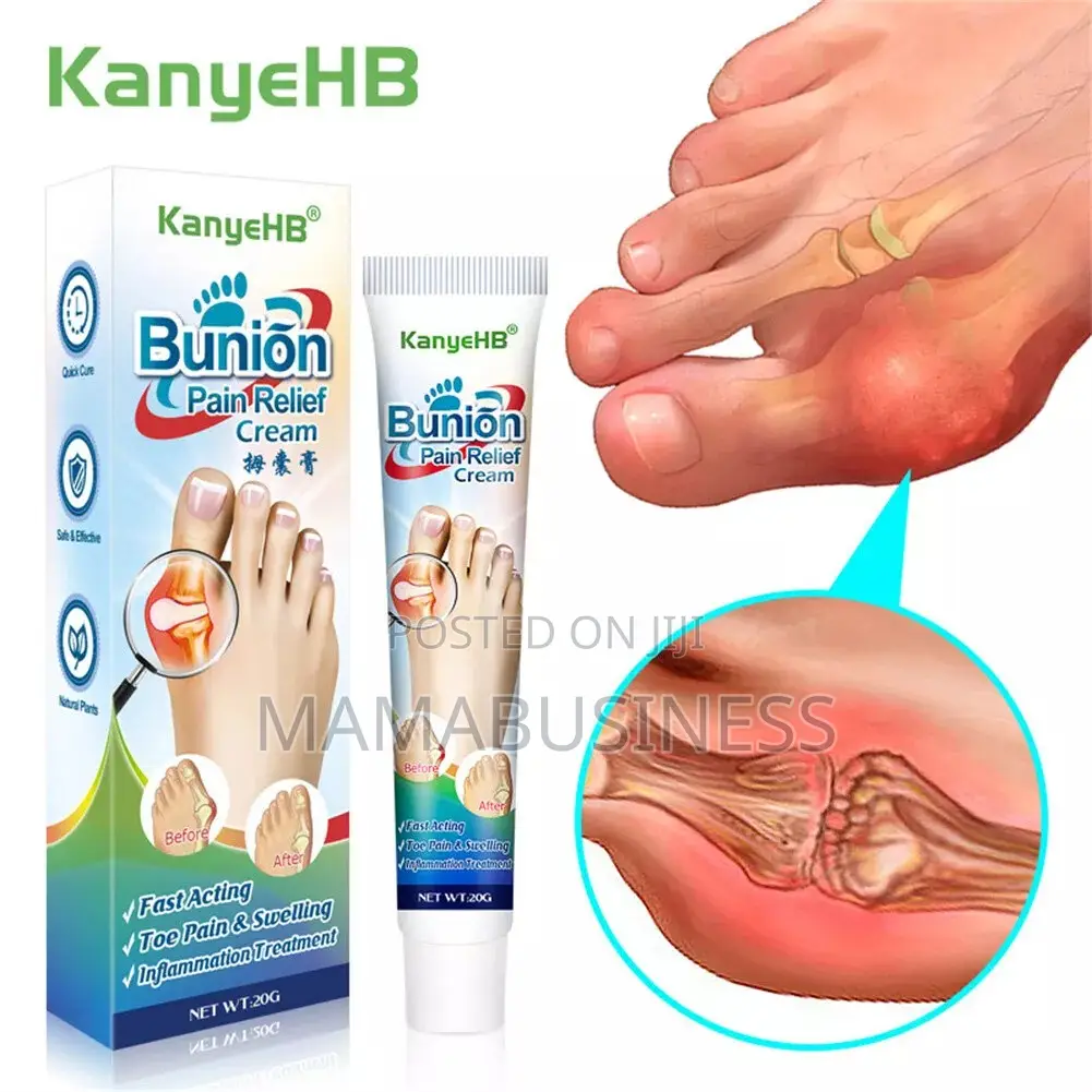 Kanyehb Bunion Pain Relief Cream - 20g
