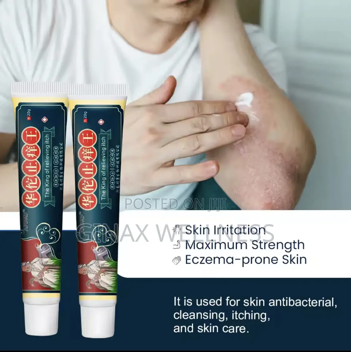 Itching Relief Cream - The King Of Relieving Itch
