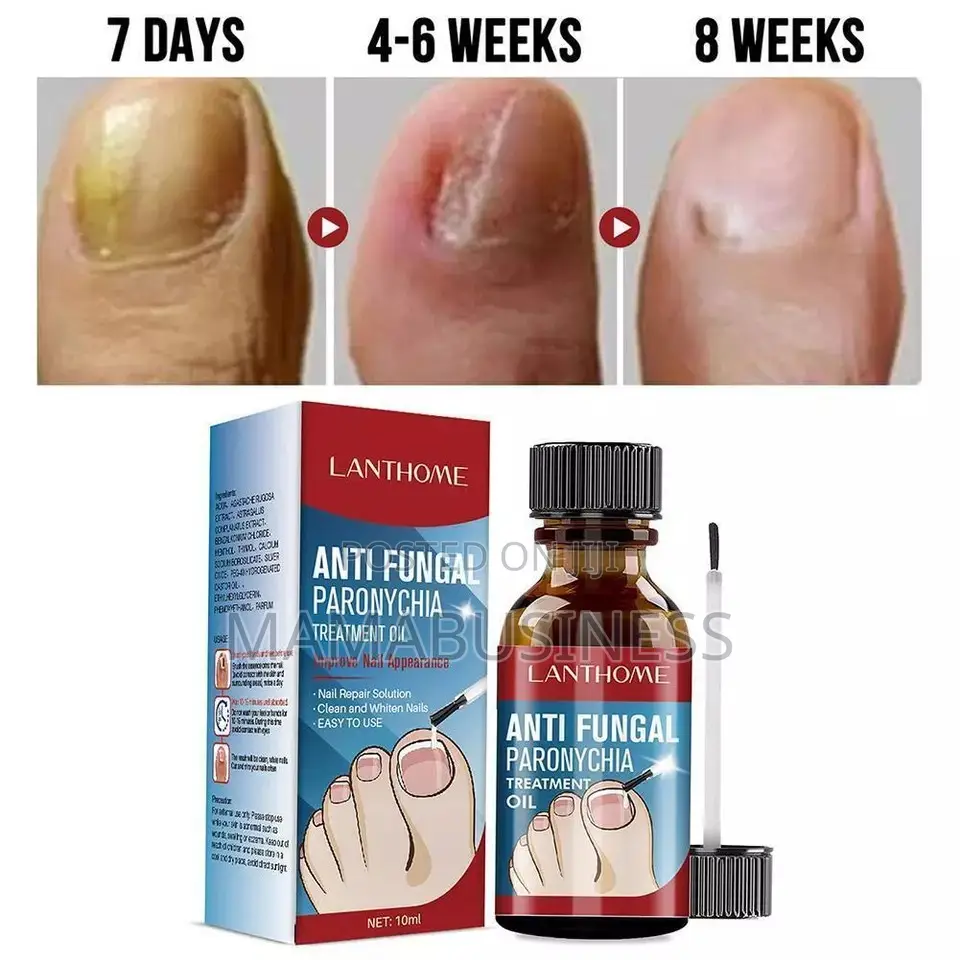 Lanthome Anti Fungal Paronychia Treatment Oil - 10ml