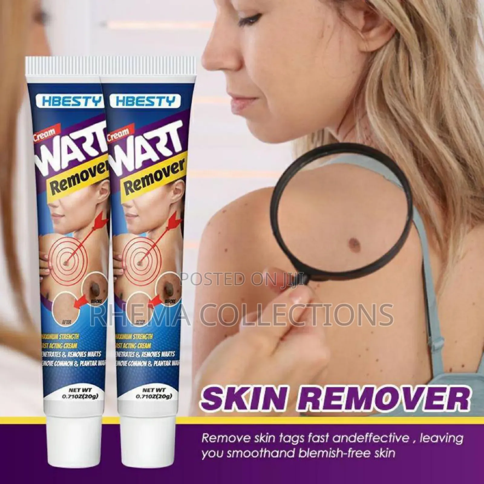 Hbesty Warts/Skin Tags Remover Cream