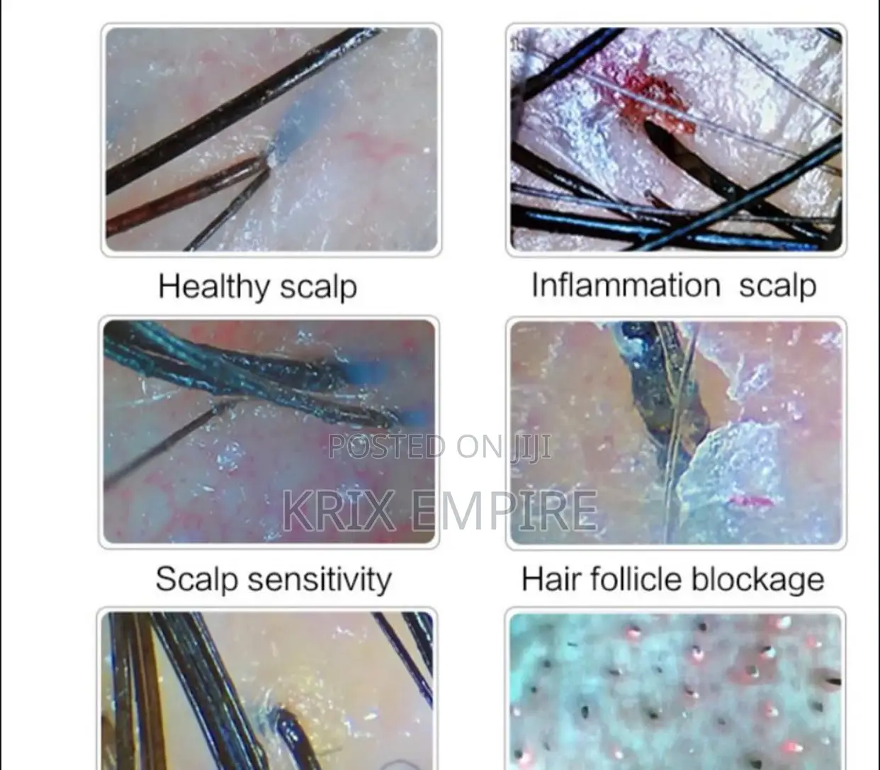 Hd Portable Skin Detector/Scalp Detector Magnifying Glass