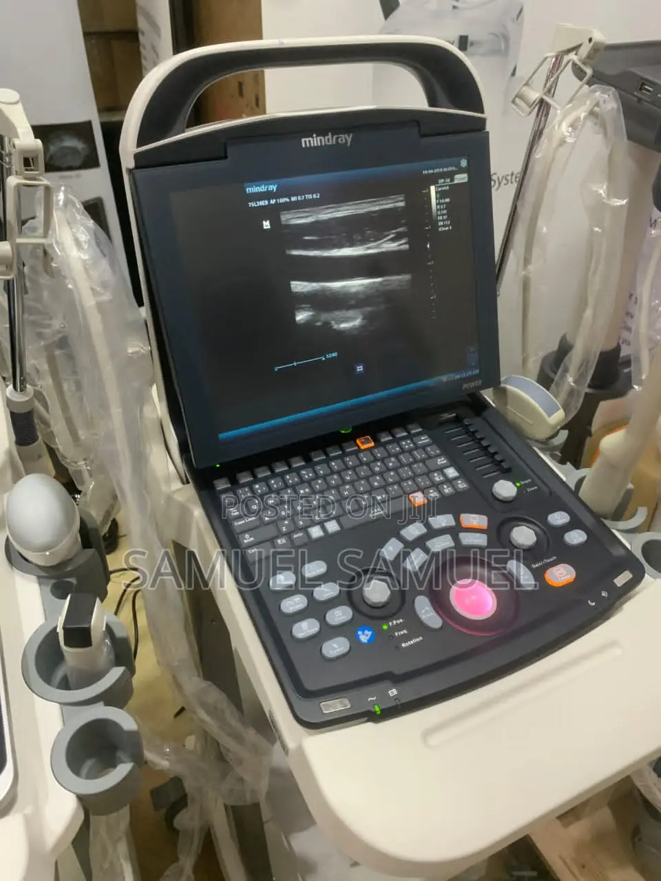 MINDRAY Dp 10 Ultrasound Machine