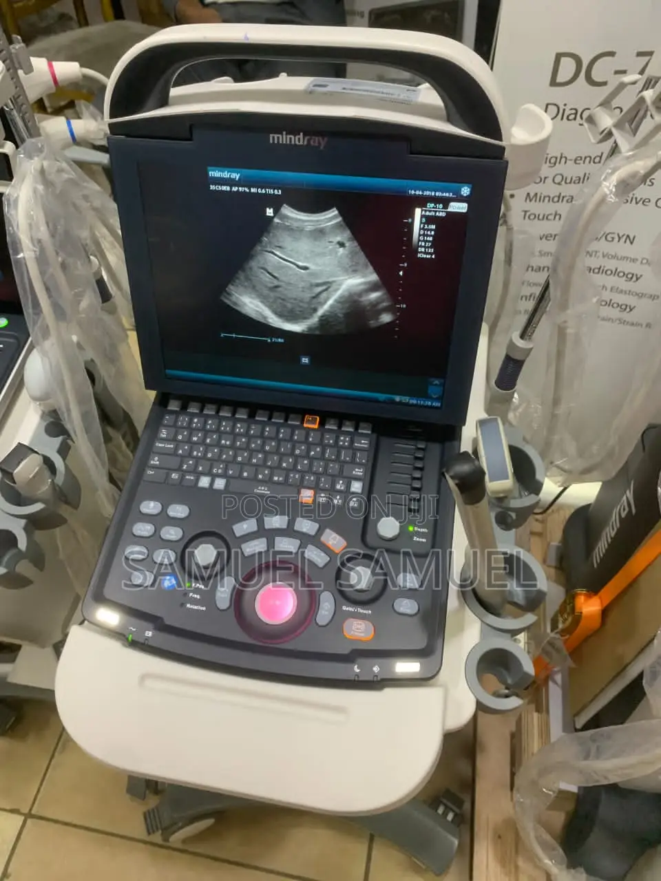 MINDRAY Dp 10 Ultrasound Machine