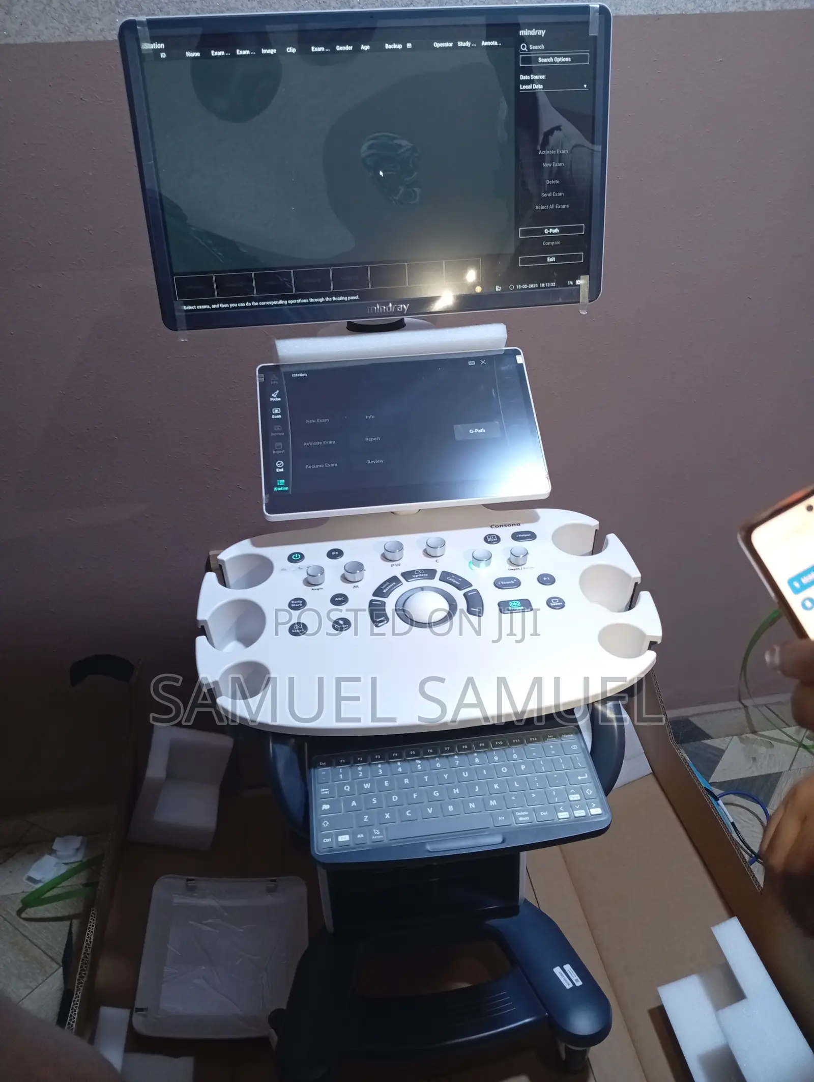 MINDRAY Consona N6 Ultrasound