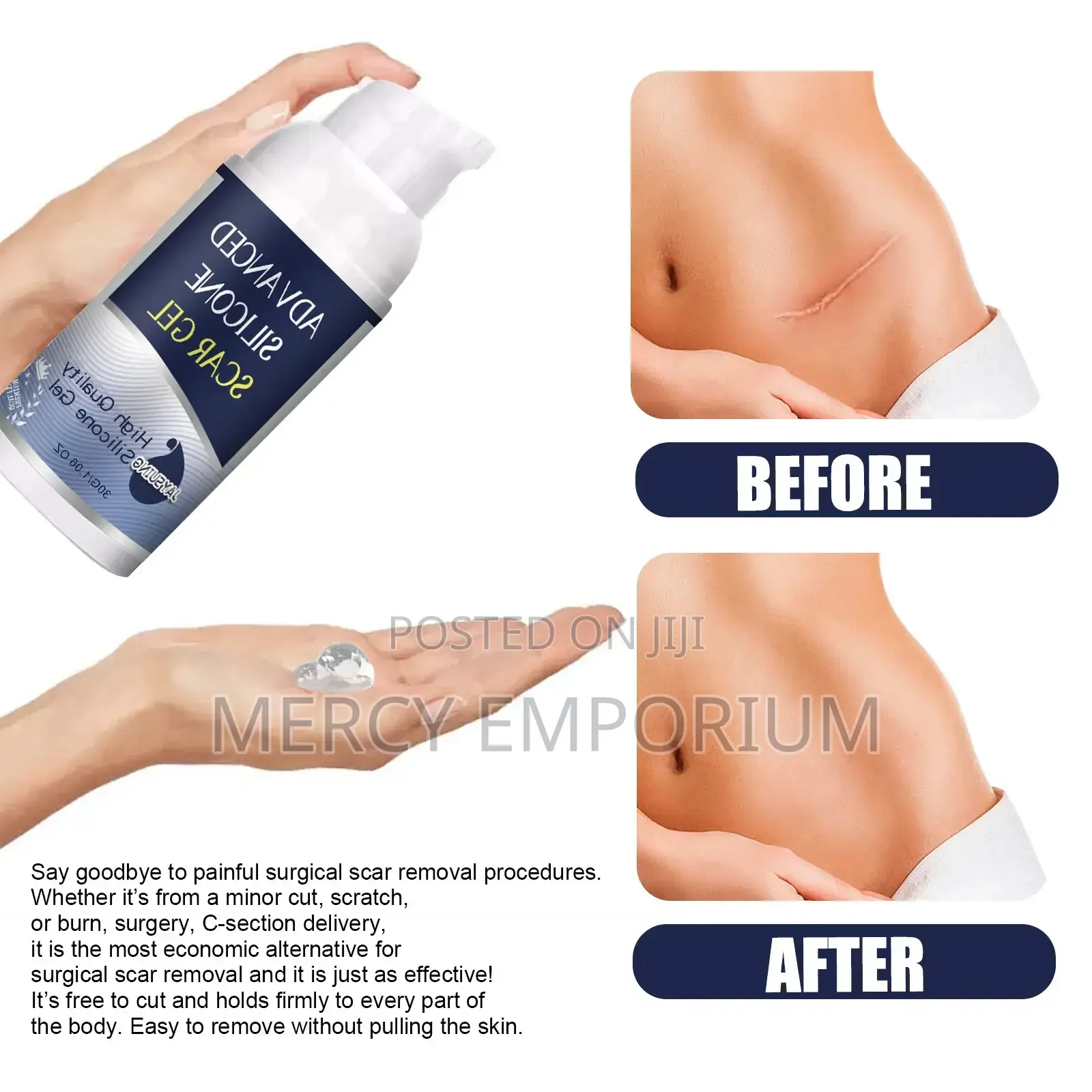 Advanced Silicone Scar Remover Gel Cream