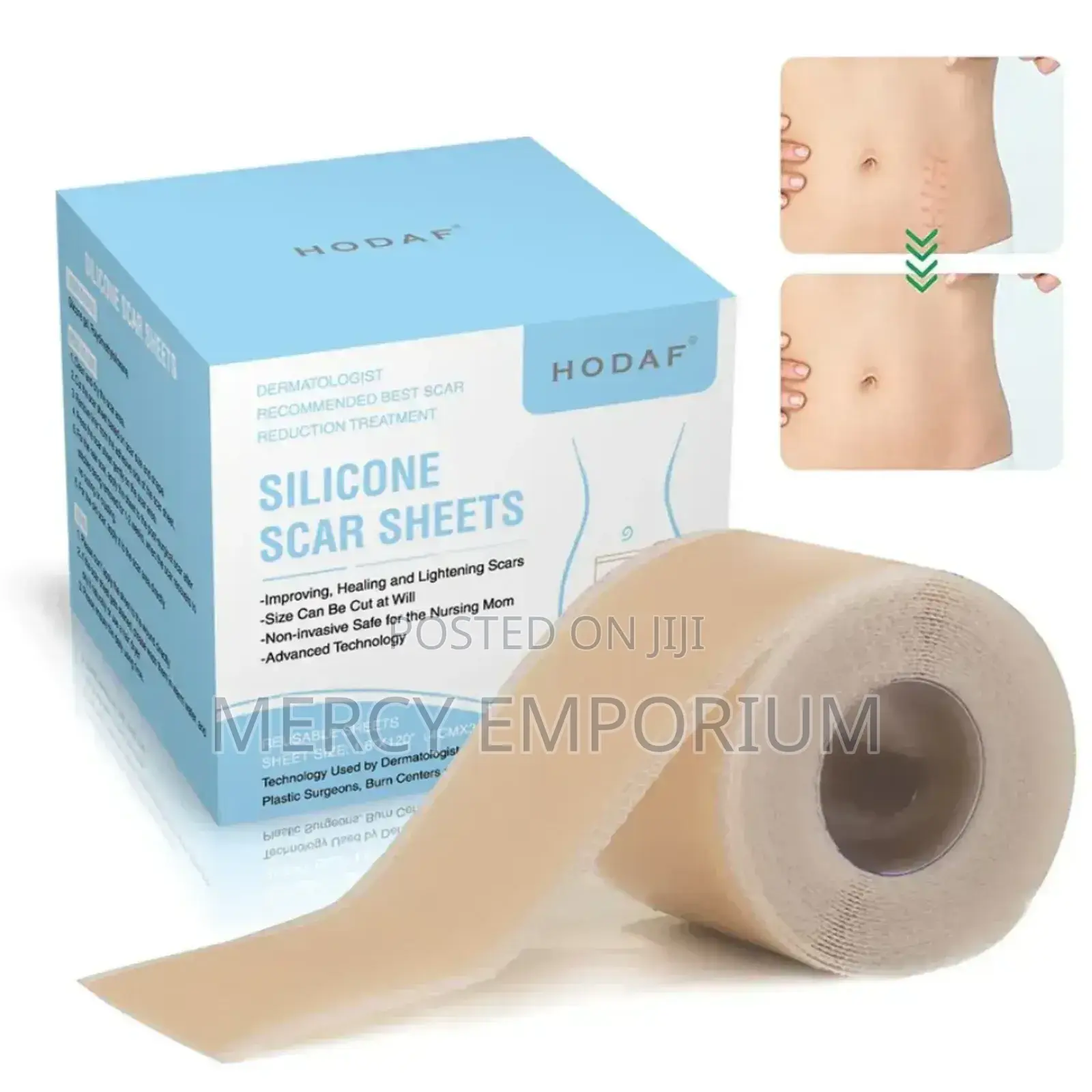 Silicone Scar Sheet. Erase Scars and Unwanted Marks