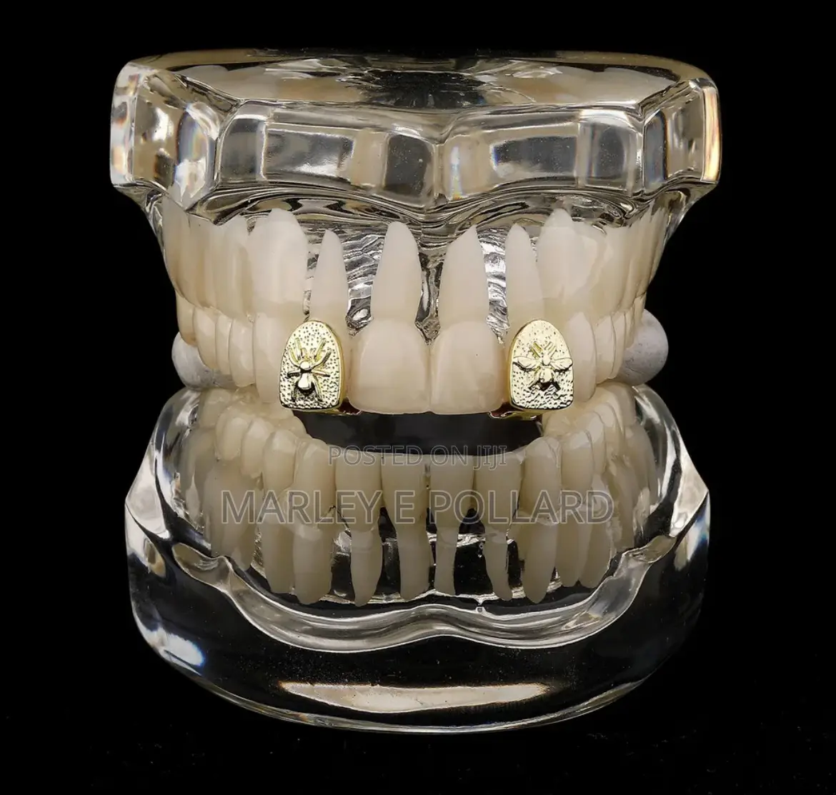 Grandeúr Luxury 14karat Gold Plated Teeth Tooth Grillz