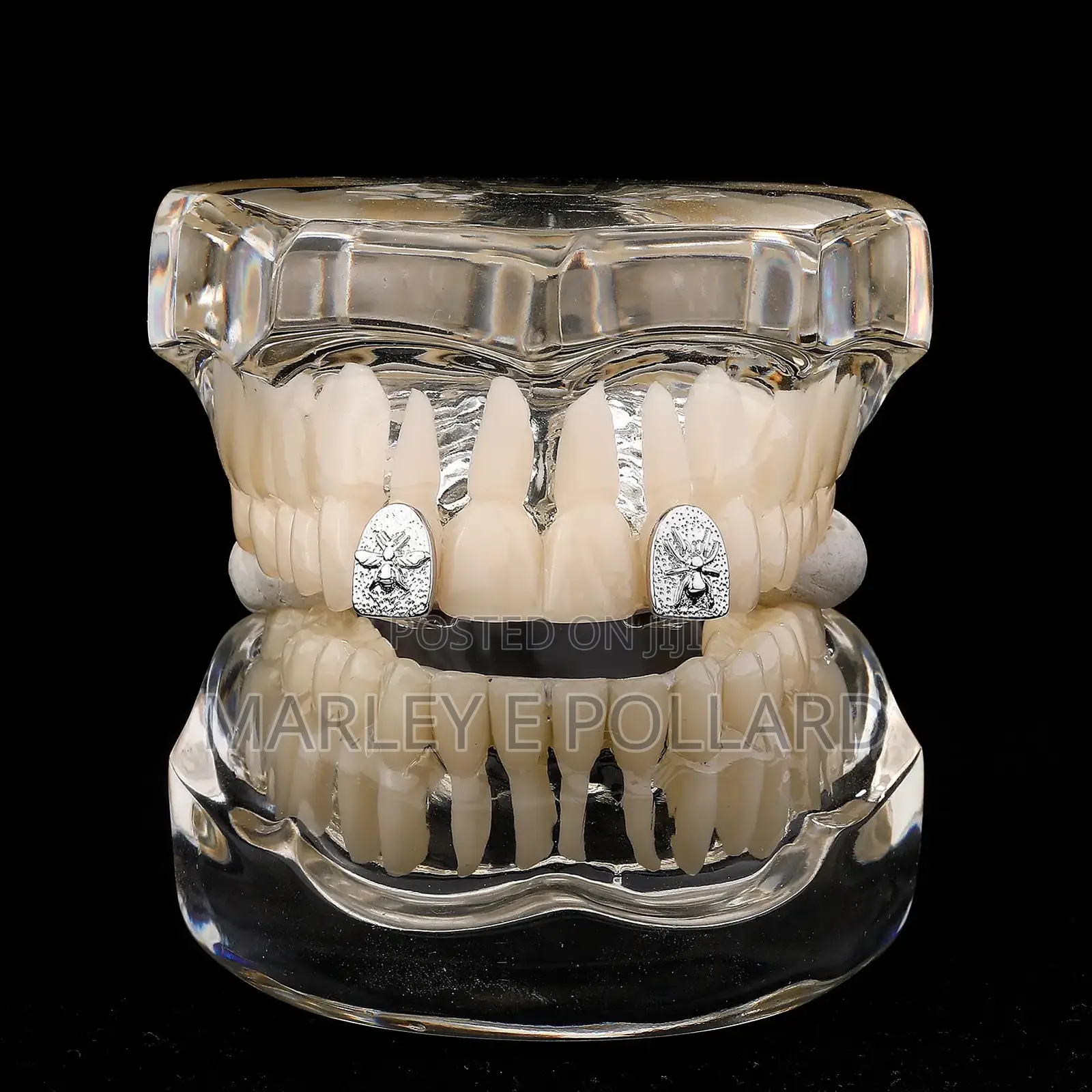 Grandeúr Luxury 14karat Gold Plated Teeth Tooth Grillz