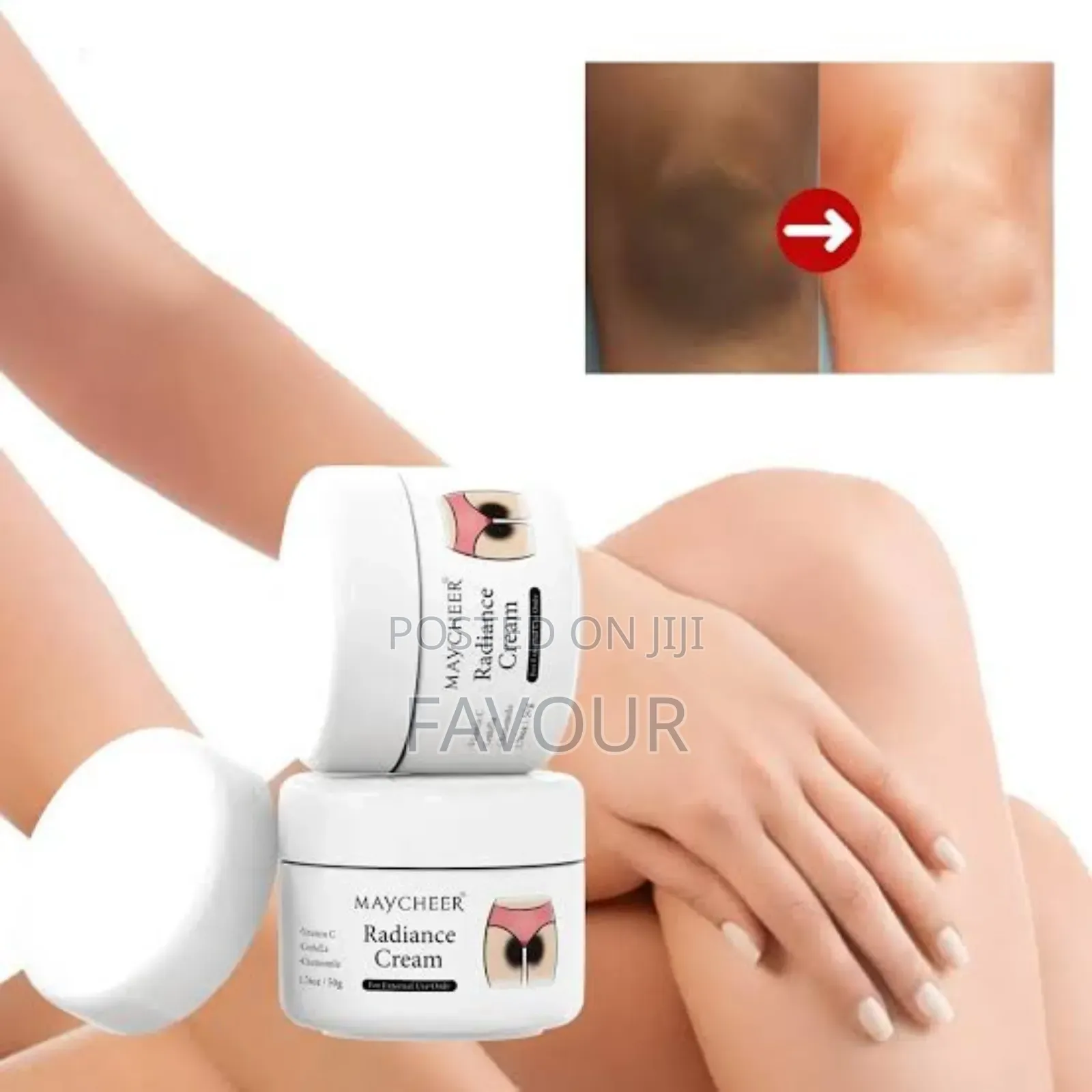 Radiance Inner Thigh Brightening Cream