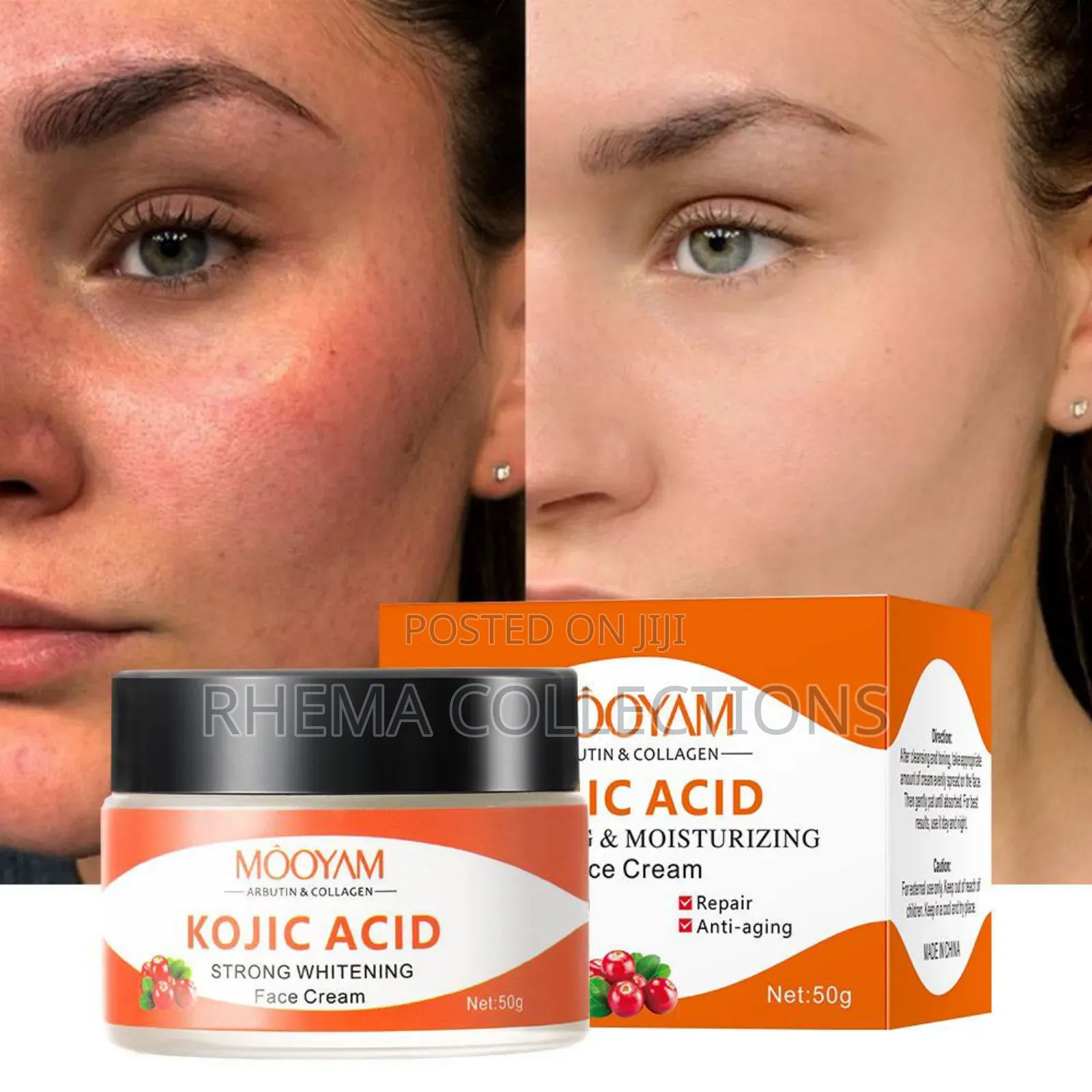 Kojic Acid Strong Whitening Face Cream
