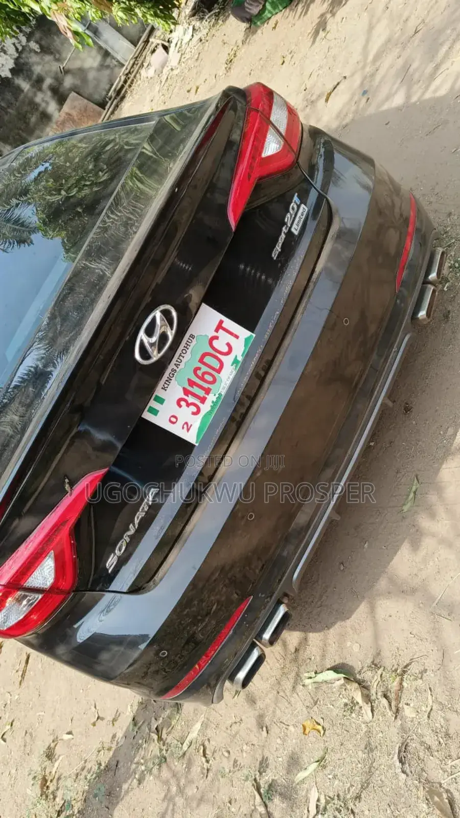 Engine Protector Front and Back for Sonata 2015-2017