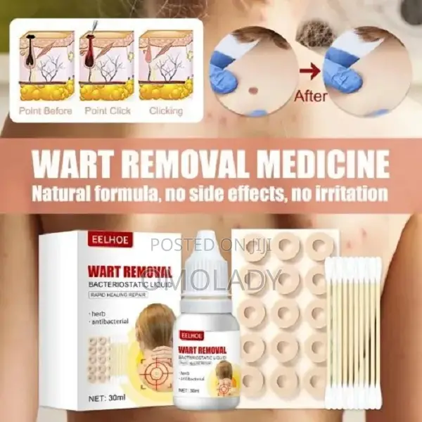 Eelhoe Wart Removal Bacteriostatic Liquid - 30ml