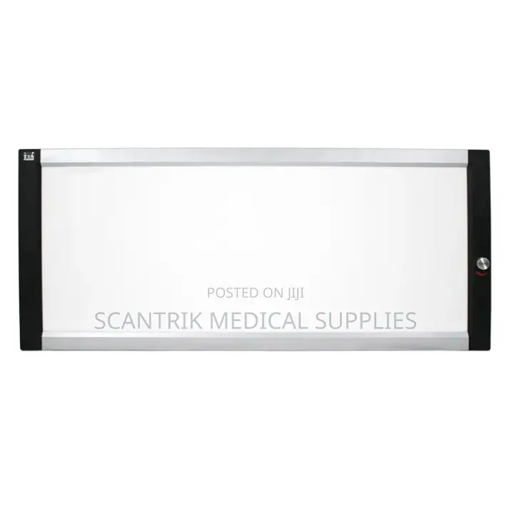 Hospital Negatoscope X-Ray Film
