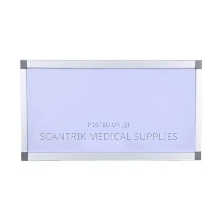 Portable X-Ray Viewer –
