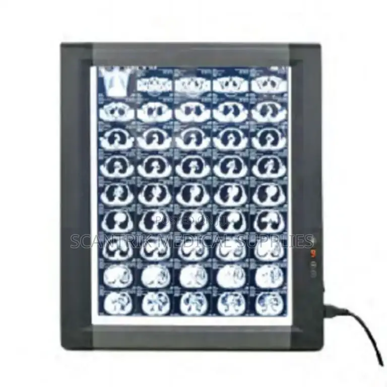 Medical Film Illuminator
