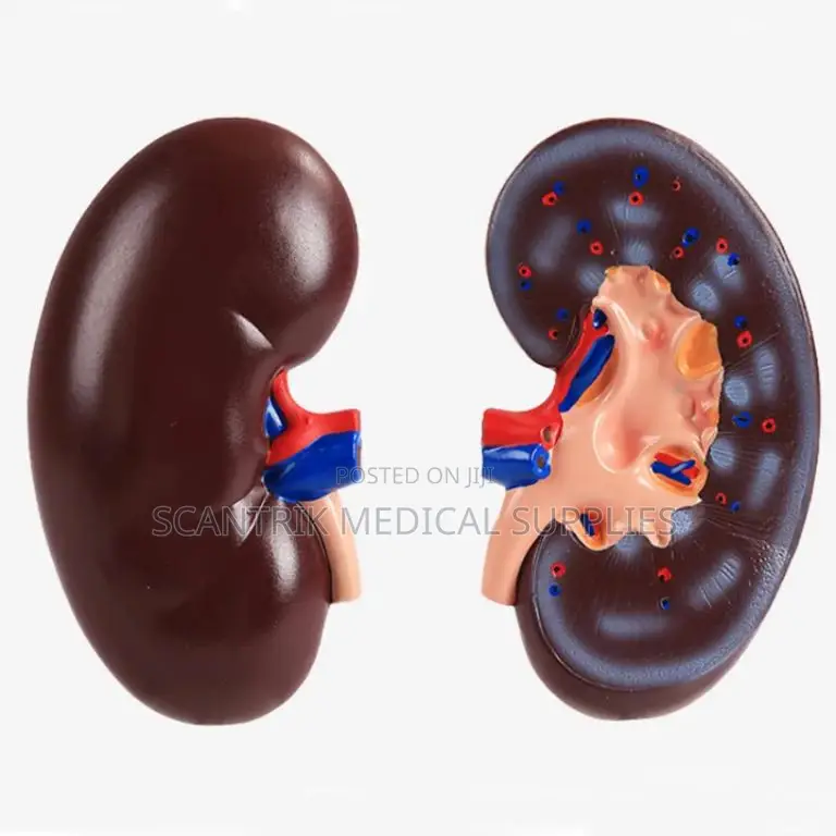 Medical Plastic Kidney Model