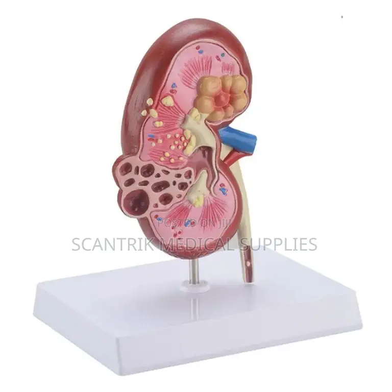 Educational Model Kidney
