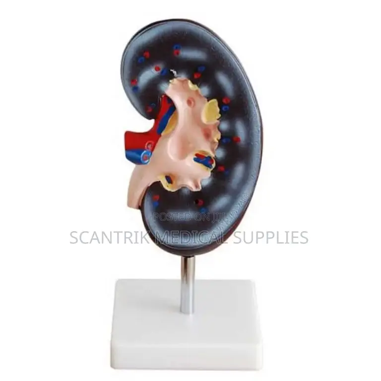 High Quality Anatomical Enlarged Model Kidney
