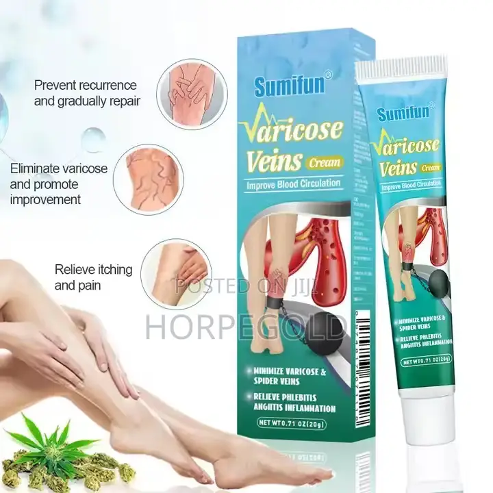 Vericose Veins Cream