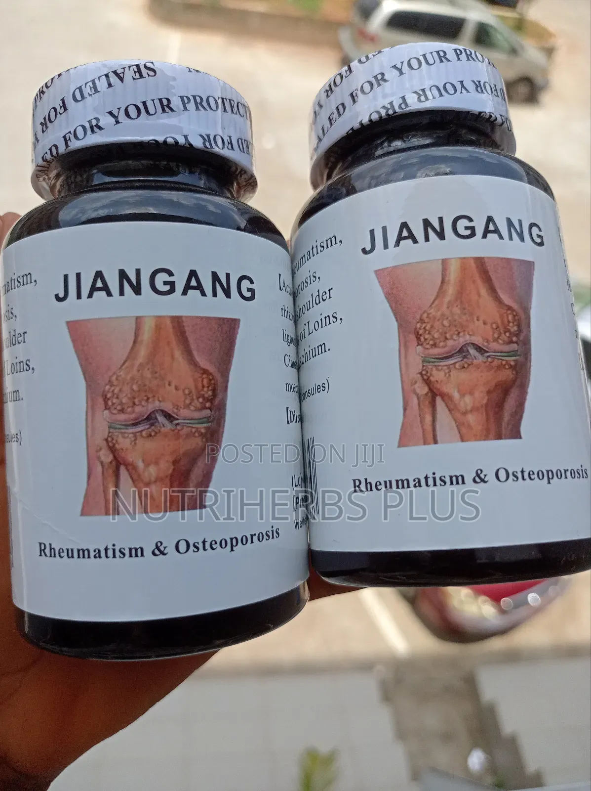 Jangang Arthritis (Wholesale Price at 5,000)