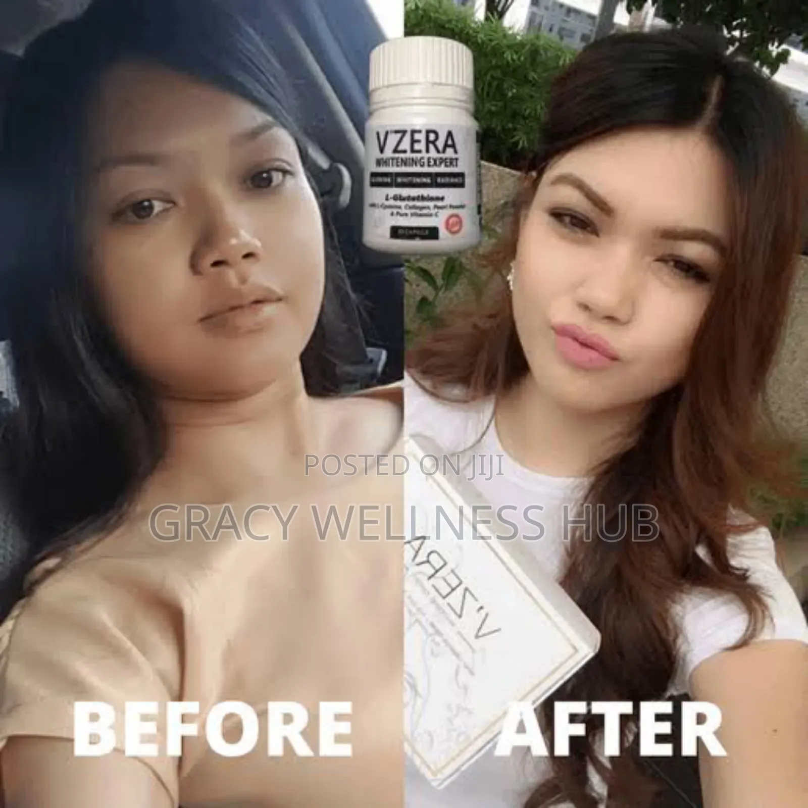 V'zera Whitening Expert