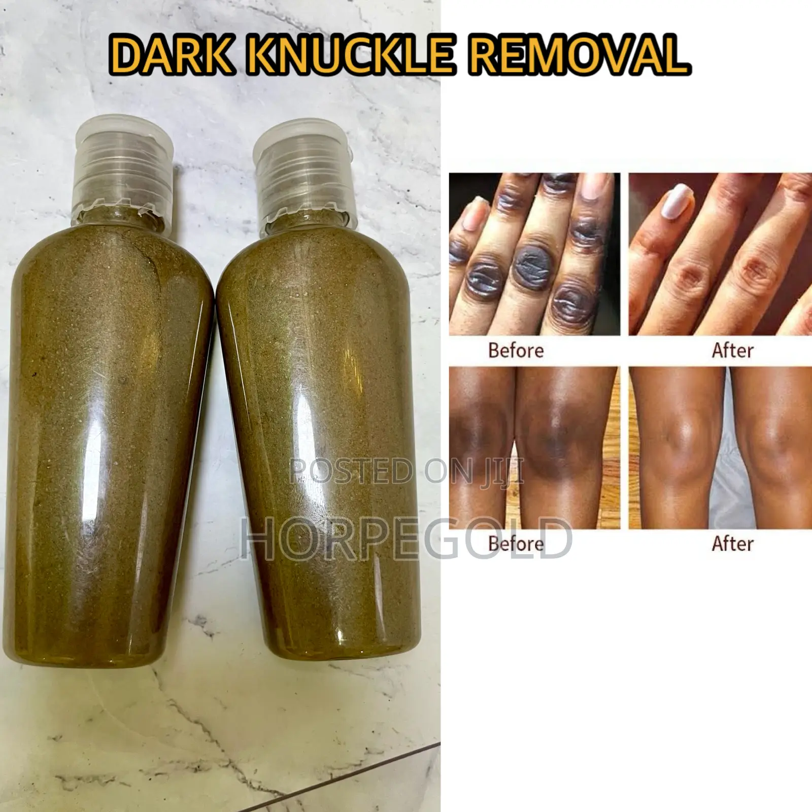 Dark Knuckle Removal