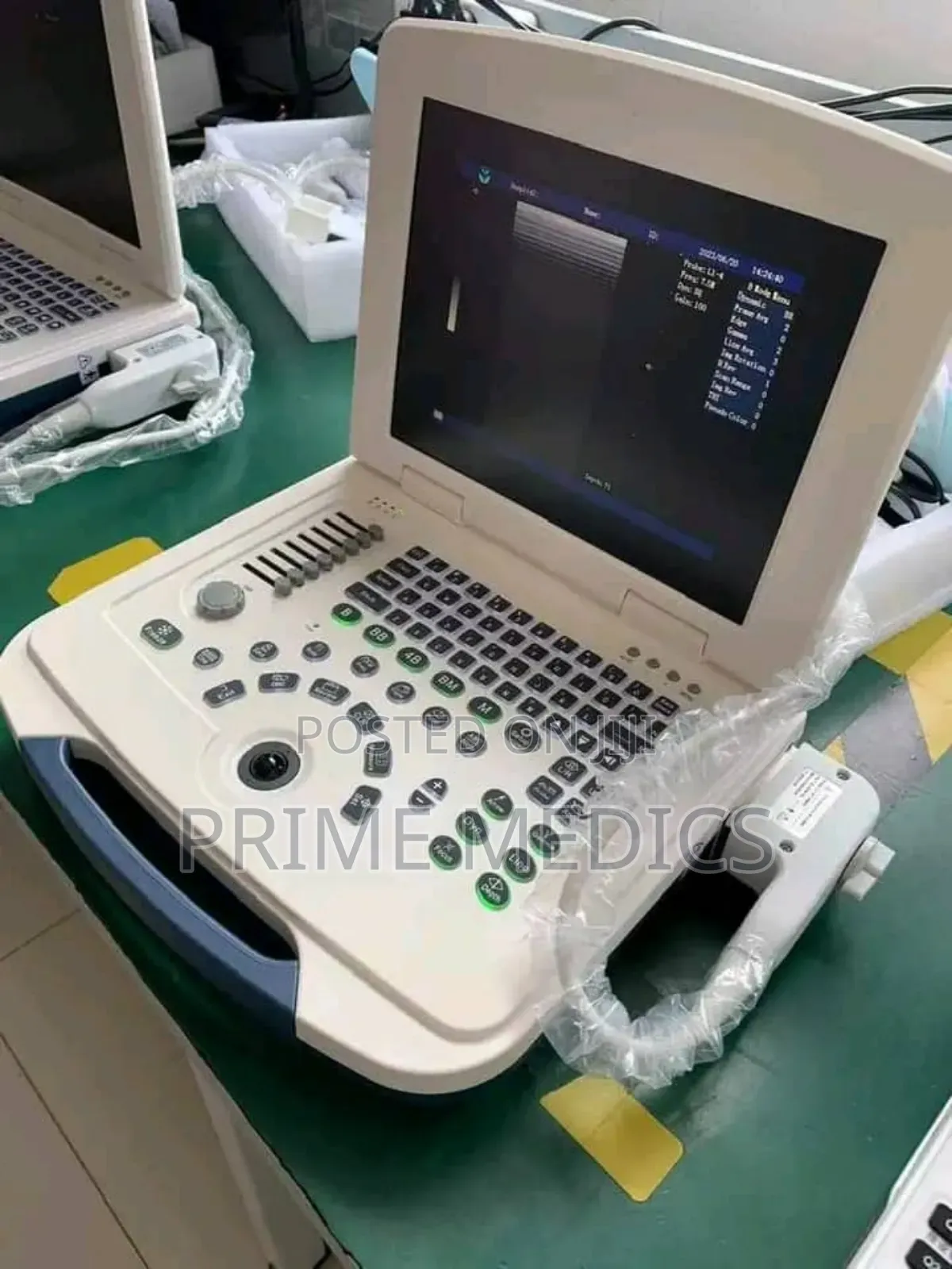 Laptop Ultrasound Machine