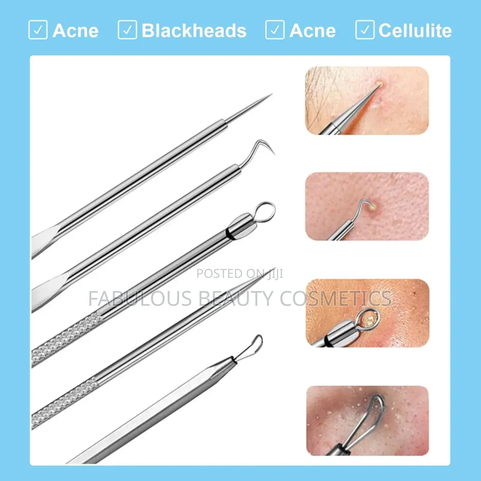 Acne Needle 4x Remover Tool Kit 4 Pimple Remover 4 Blackhead
