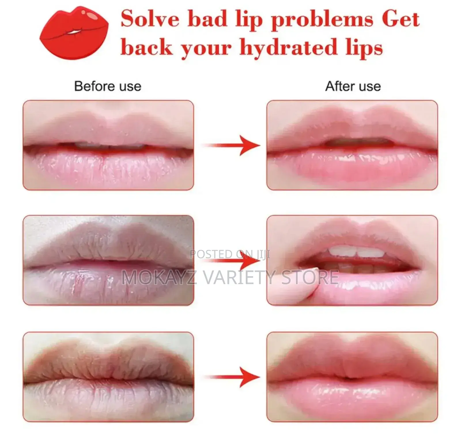 Collagen Fruit Lip Mask (Sk-Hans Brand) 10 Pieces